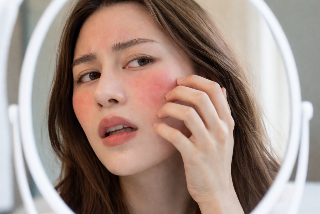 Skin-allergies-treatment-at-gurugram-and-Rewari