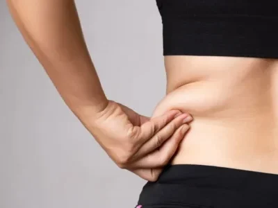 weight-loss-treatment-cool-sculpting