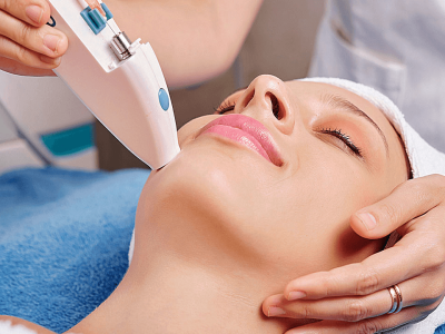 Laser Skin Tightening